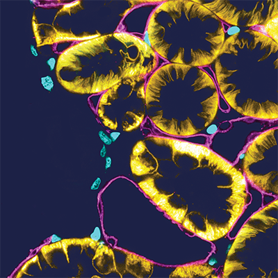 Tubules square_small